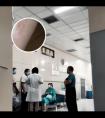 308激光照完白斑黑了正常吗